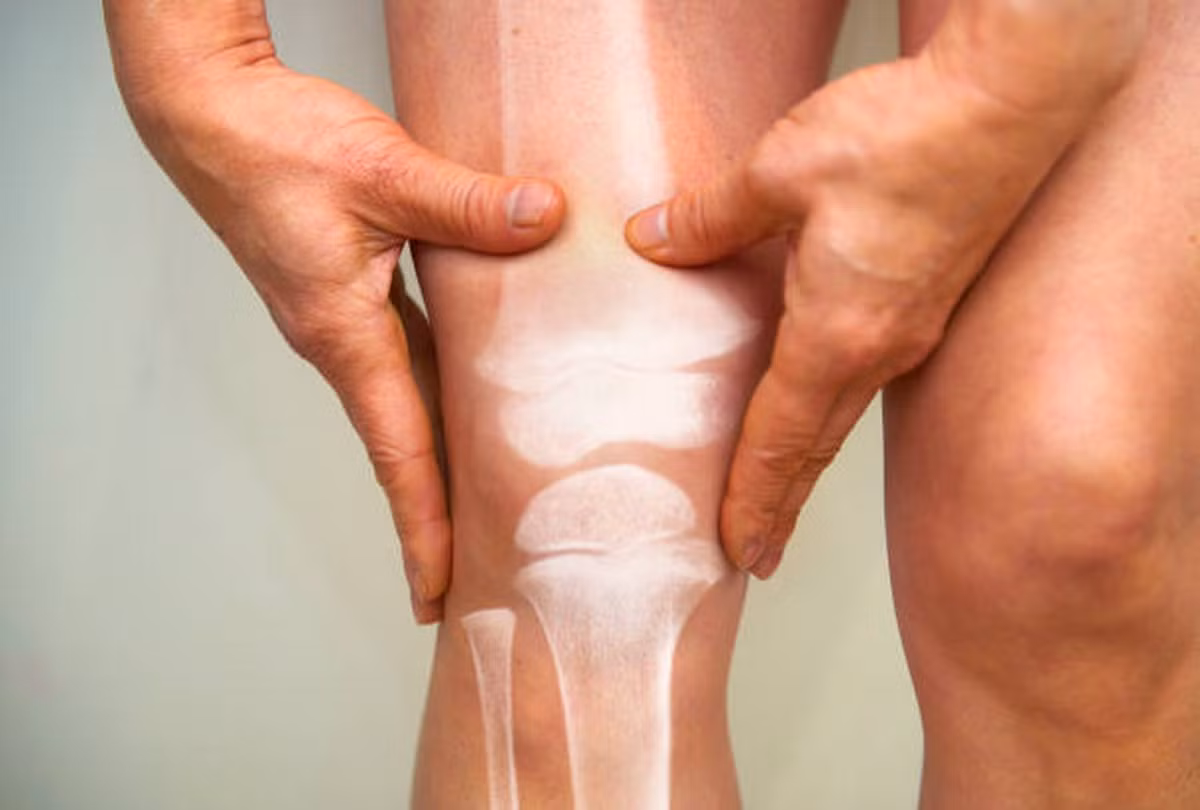 Kết hợp dinh dưỡng và vận động là chìa khóa vàng để bảo vệ xương (Ảnh: Getty images)